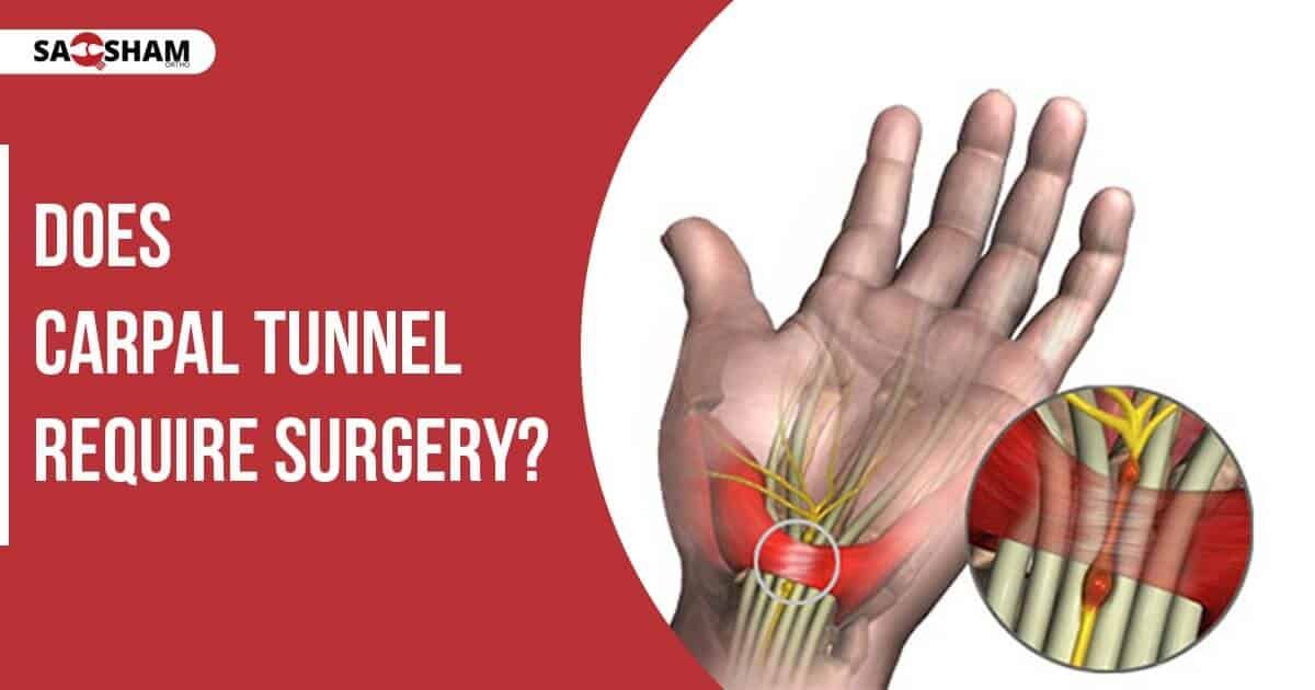 does-carpal-tunnel-require-surgery-saqsham-ortho