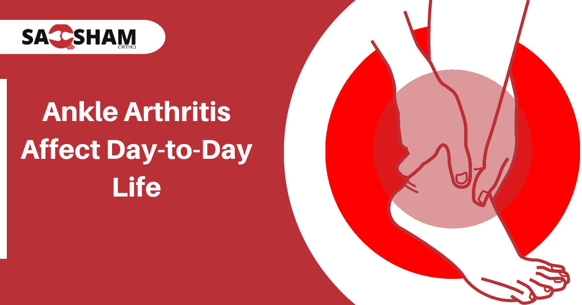 Ankle Arthritis Affect Day-to-Day Life - Saqsham Ortho