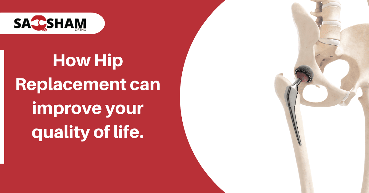 How Hip Replacement can improve your quality of life. Saqsham Ortho